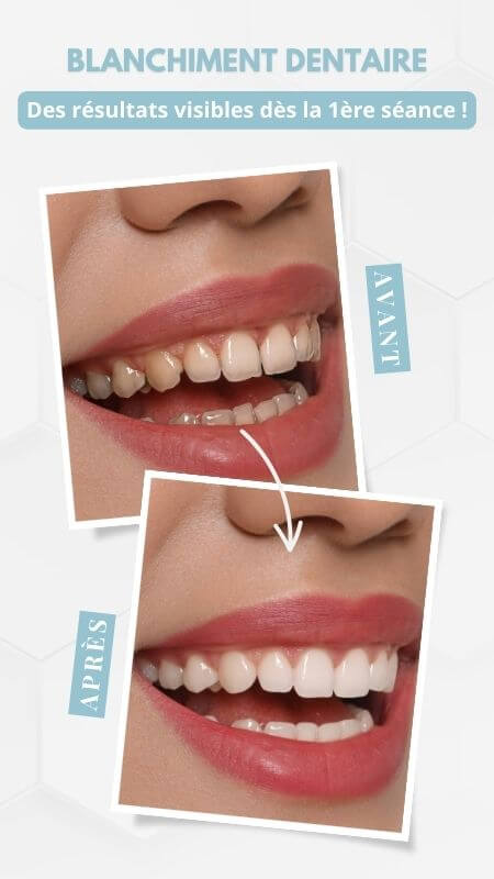 Exemple de campagne d'affichage dynamique dans un cabinet de dentistes